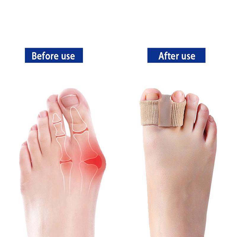 Bunion Reliever
