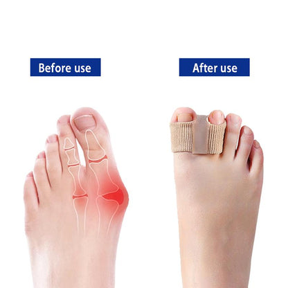 Bunion Reliever